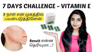 💥💥7 DAYS CHALLENGE  VITAMIN E CAPSULE  How to use vitamin e capsule  Ebina Giftlin [upl. by Hgieloj]