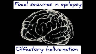 Focal epilepsy olfactory temporal lobe seizures explained [upl. by Catlaina]