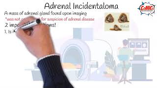 CoMICs Episode 1 Adrenal incidentaloma [upl. by Glaudia]