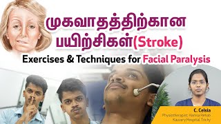 முகவாதத்திற்கான பயிற்சிகள் Stroke  Exercises amp Techniques for Facial Paralysis  Tamil [upl. by Asnarepse]