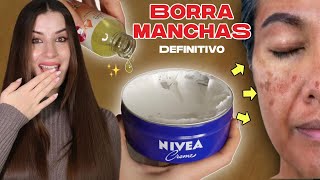 Manchas y Arrugas Profundas Diles ADIÓS con sólo 3 Ingredientes Potentes [upl. by Maribeth982]