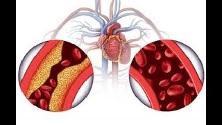 Olmesartan medoxomil review  olmesartan medoxomil side effects  Olmesartan medoxomil for high BP [upl. by Collie756]