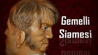 Gemelli Siamesi  Creepypasta 64 [upl. by Adnanref]