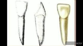 Denticion temporal  Odontología IPN [upl. by Orimlede]