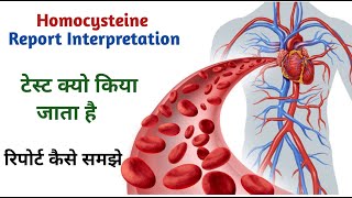 homocysteine blood test report II Homocysteine blood test [upl. by Eibbob]