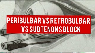 OCULAR ANAESTHESIA  peribulbar block retrobulbar block and subtenons block [upl. by Jenni887]