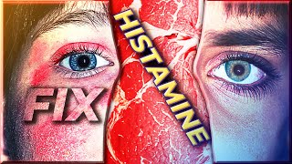 How I fixed my Histamine Intolerance [upl. by Gehman104]