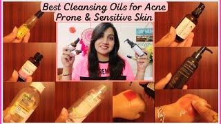 8 Best Cleansing Oils and Balms  Micellar Waters for Oily Acne Prone and Sensitive Skin in India [upl. by Konstantin]