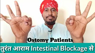 How to Help Clear an Intestinal Blockage Hindi  Exercise for Ostomy Patients to avoid gas Blockage [upl. by Eveneg941]