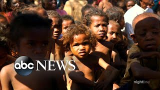 Why people in Madagascar are starving  Start Here [upl. by Naimerej]