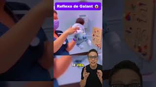 Reflexo de Galant😱👶 medicina medico pediatria enfermagem enfermeira pediatriaonline pediatra [upl. by Norit]