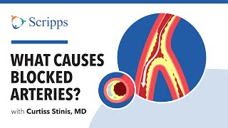 Coronary Artery Disease Causes Symptoms and Treatment with Dr Curtiss Stinis  San Diego Health [upl. by Issim400]