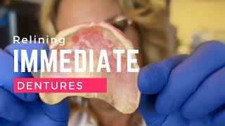 Converting Immediate Denture to Permanent Denture by permanent Reline procedure [upl. by Hobard]