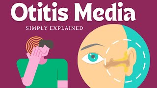 Otitis Media Understanding Ear Infections [upl. by Pedrotti595]