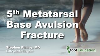 5th Metatarsal Base Avulsion Fracture [upl. by Yslek]