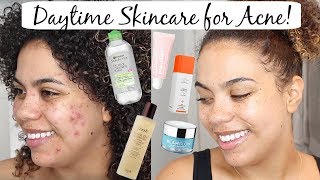 Daytime Skincare Routine for AcneOilyScarring  Post Cystic Acne Skincare [upl. by Asilrac158]