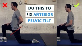 6 Minute Routine to Correct ANTERIOR Pelvic Tilt [upl. by Sigismundo]