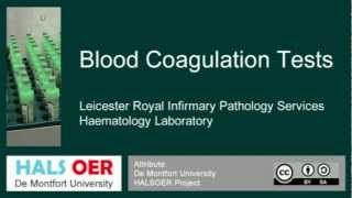 Automated Blood Analyser Part 6 CoagulationTest [upl. by Llirrehs]