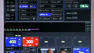 4E  Pacing Protocols  MultiSx 1 VT Study Basic [upl. by Eyatnod]