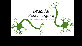 Brachial Plexus Injury  Erbs palsy and Klumpkes palsy [upl. by Wicks]