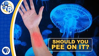 Does Peeing on a Jellyfish Sting Make it Stop Hurting [upl. by Raney]