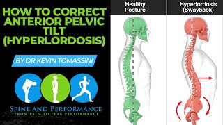 How to Correct Anterior Pelvic Tilt Hyper Lordosis [upl. by Llenwad]