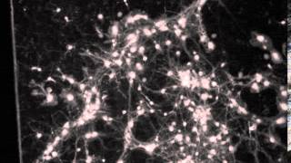 Calcium imaging in neuronal culture [upl. by Cristabel686]