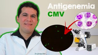 Antigenemia para Citomegalovírus CMV [upl. by Yattirb549]