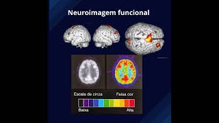 Fonoaudiologia e Neuroimagem [upl. by Anselme564]