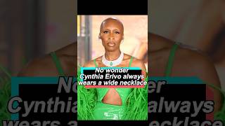 No wonder Cynthia Erivo always wears a wide necklace she’s hiding a secretcelebrity foryou usa [upl. by Aelaza387]