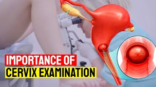 How to Test Your Cervix for Pregnancy at Home  Importance of Cervix Examination for Womens Health [upl. by Gunas]