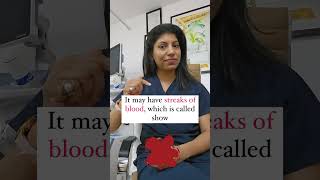 Vaginal discharge in pregnancy Doc Explains drbhumikabansal trending pregnancy discharge [upl. by Broek]