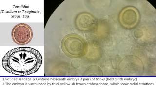 34 Practical Parasitology  Eggs of T Solium and T Saginata [upl. by Airres]