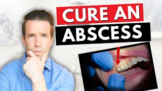 Dentist Explains a Tooth Abscess  How to Cure an Abscess Tooth [upl. by Yeslehc134]