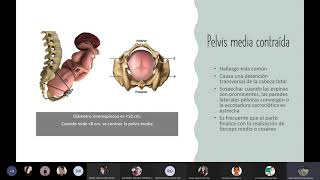 Clase 3 Distocia de pelvis [upl. by Norry]