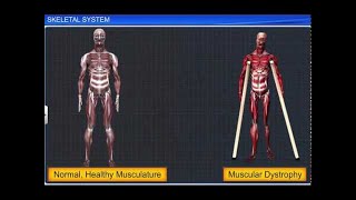 CBSE Class 11 Biology  Skeletal System [upl. by Hgieliak]