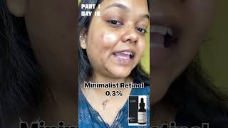 Minimalist Retinol 03 on sensitive skinPart 1 shortvideo reelindia skincareroutine skincare [upl. by Larner]