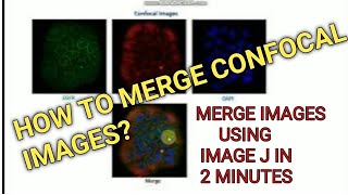 How to merge two or more images using Image J II Xgene and proteinX [upl. by Kirwin]