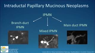 Approach to Cystic Lesions of the Pancreas [upl. by Cindie]