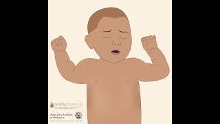 RSV Signs amp Symptoms in Babies  AAP shorts [upl. by Dunn]