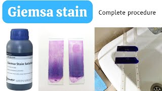 Giemsa Stain Procedure for Blood SmearHow to do Giemsa StainGiemsa Staining ProcedureAdnanMLT [upl. by Eneliak297]