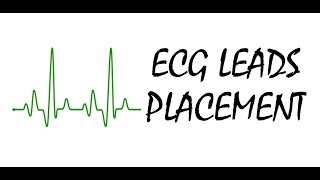 Placement Of ECG Limb amp Chest Leads [upl. by Nevuer]