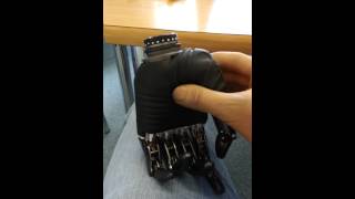 BeBionic V3 Hand Prosthesis by Otto Bock [upl. by Naihtniroc]