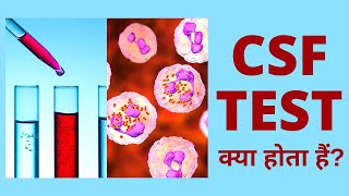 CSF Test Procedure in Hindi  CSF Test क्या होता हैं कैसे होता हैं [upl. by Ilaire880]