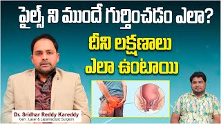 Piles Laser Treatment in Telugu  Piles Symptoms and Treatment  Treatment Range Hospital [upl. by Rother465]