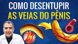 Como desentupir as veias do pênis para ter melhores ereções [upl. by Nnov]