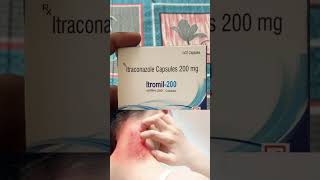 Itromil200  Itraconazole Capsule 200 mg  short ringworm medicinetuber viralshorts [upl. by Scottie]