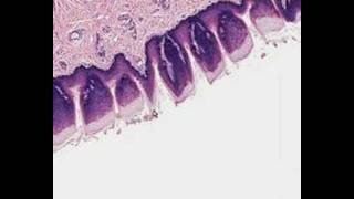 Shotgun Histology Tongue [upl. by Asilanna]