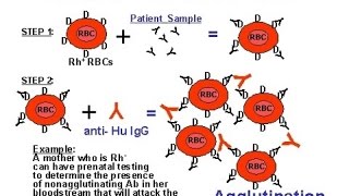 Direct and Indirect Coombs test  Background and how to perform the Coombs Test [upl. by Partridge]