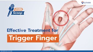 Effective Treatment for Trigger Finger  Vejthanis Scoop [upl. by Ueihttam]